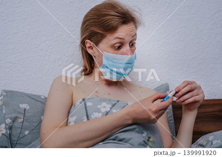 Young woman with chickenpox wearing medical mask looks at the thermometer in surprise Young woman with chickenpox wearing medical mask looks at the thermometer in surprise 139991920