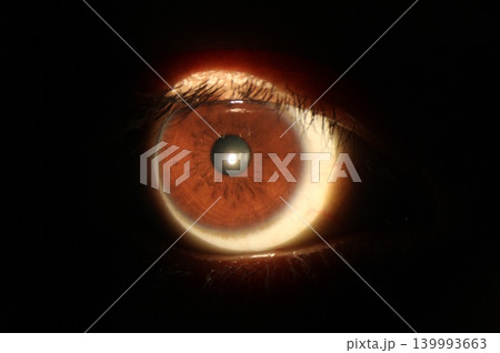 Ophthalmic anterior segment image revealing iris surface crypts 139993663