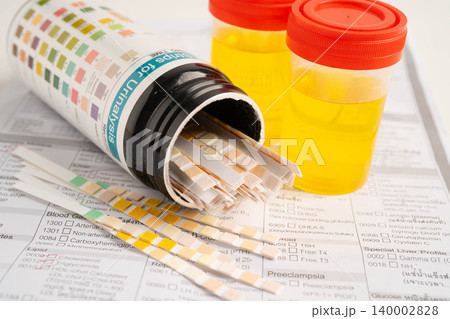 Urinalysis, urine cup with reagent strip pH paper test and comparison chart in laboratory. 140002828