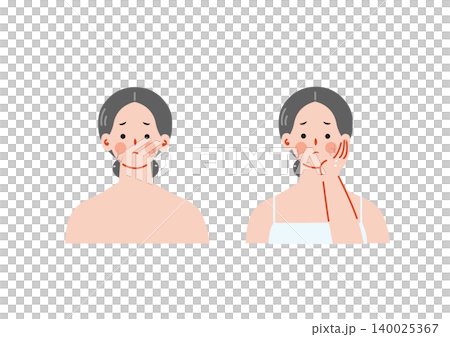 Illustration of a woman suffering from dry skin Illustration of a woman suffering from dry skin 140025367