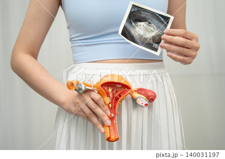 Uterus ultrasound, Asian woman holding human anatomy model. 140031197