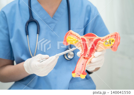 Uterus, doctor holding human anatomy model for study diagnosis and treatment in hospital. Uterus, doctor holding human anatomy model for study diagnosis and treatment in hospital. 140041550