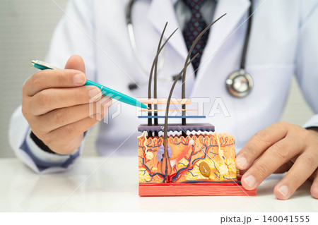 Hair transplant, Asian dermatologist doctor holding skin structure anatomy model for treatment in hospital. Hair transplant, Asian dermatologist doctor holding skin structure anatomy model for treatment in hospital. 140041555