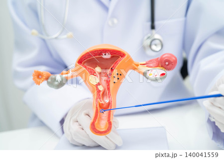 Doctor holding human uterus model for vaginal and cervix pap smear check up in the obstetrics and gynecology. Doctor holding human uterus model for vaginal and cervix pap smear check up in the obstetrics and gynecology. 140041559
