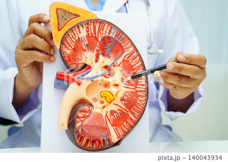 Chronic kidney disease, doctor with model for treatment urinary system, urology, Estimated glomerular filtration rate eGFR. Chronic kidney disease, doctor with model for treatment urinary system, urology, Estimated glomerular filtration rate eGFR. 140043934