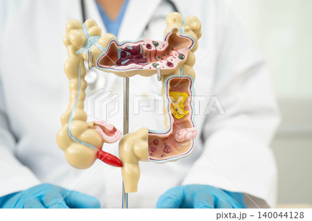 Intestine, doctor holding human anatomy model for study diagnosis and treatment in hospital. Intestine, doctor holding human anatomy model for study diagnosis and treatment in hospital. 140044128