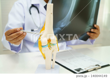 Doctor examining knee joint bone radiography xray film. 140044149