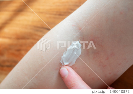 Skincare like help for the skin with acne or dermatitis. Hand of girl apply the moisturizing cream on her body in bathroom. Bodycare every day. 140048872