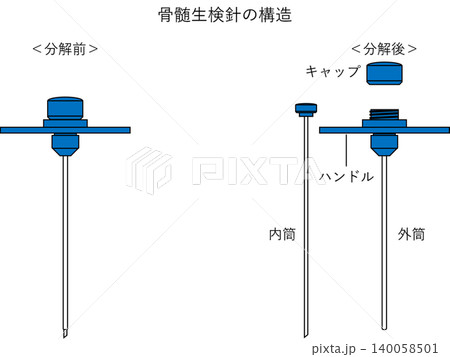 骨髄生検針の構造 骨髄生検針の構造 140058501