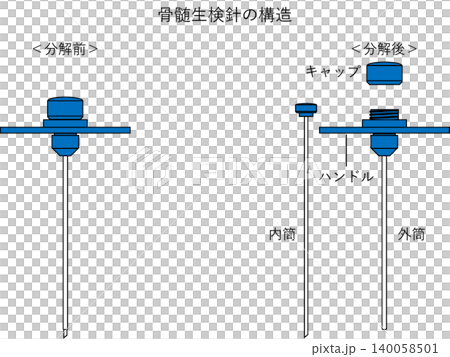 骨髄生検針の構造 骨髄生検針の構造 140058501