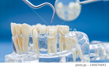 Endodontics and dental examination concept. Macro view of clear jaw model showing tooth roots and dentist explorer tool. 140074841