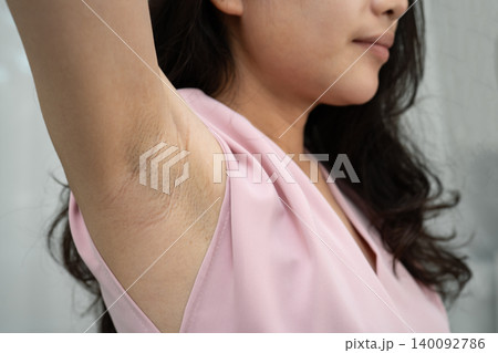 Asian woman have problem black armpit beauty skin care. Asian woman have problem black armpit beauty skin care. 140092786