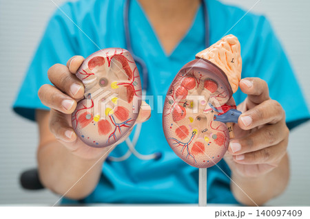 Chronic kidney disease, Asian woman with model for treatment urinary system, urology, Estimated glomerular filtration rate eGFR. Chronic kidney disease, Asian woman with model for treatment urinary system, urology, Estimated glomerular filtration rate eGFR. 140097409