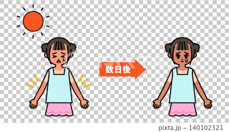 日焼けによる時間の経過を表現した図解 140102321