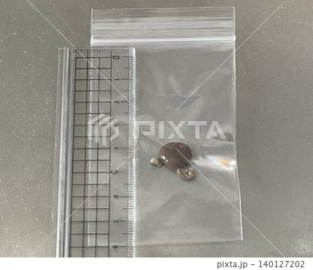 手術で取り出した猫の尿路結石 手術で取り出した猫の尿路結石 140127202