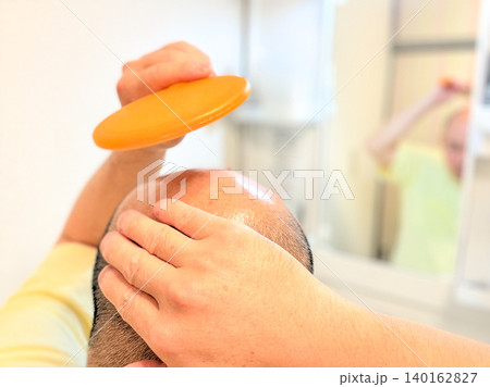 薄毛に悩む中年の男性 140162827