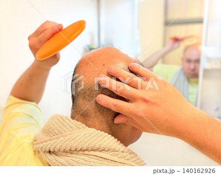 薄毛に悩む中年の男性 薄毛に悩む中年の男性 140162926