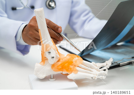 Doctor examining foot ankle joint bone radiography xray film. Doctor examining foot ankle joint bone radiography xray film. 140189651