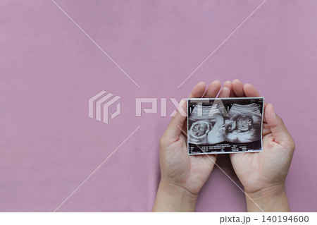 Soft pink background highlights tender hands holding ultrasound photo. Fingers cradle precious baby image, face and hands clearly visible. Moments of joy, wonder, and anticipation captured in simple Soft pink background highlights tender hands holding ultrasound photo. Fingers cradle precious baby image, face and hands clearly visible. Moments of joy, wonder, and anticipation captured in simple 140194600