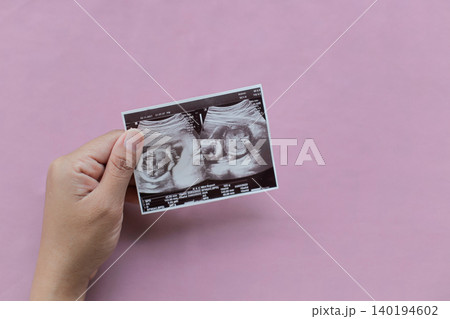 Soft pink background highlights tender hands holding ultrasound photo. Fingers cradle precious baby image, face and hands clearly visible. Moments of joy, wonder, and anticipation captured in simple Soft pink background highlights tender hands holding ultrasound photo. Fingers cradle precious baby image, face and hands clearly visible. Moments of joy, wonder, and anticipation captured in simple 140194602