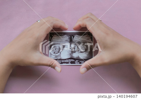 Soft pink background highlights tender hands holding ultrasound photo. Fingers cradle precious baby image, face and hands clearly visible. Moments of joy, wonder, and anticipation captured in simple Soft pink background highlights tender hands holding ultrasound photo. Fingers cradle precious baby image, face and hands clearly visible. Moments of joy, wonder, and anticipation captured in simple 140194607