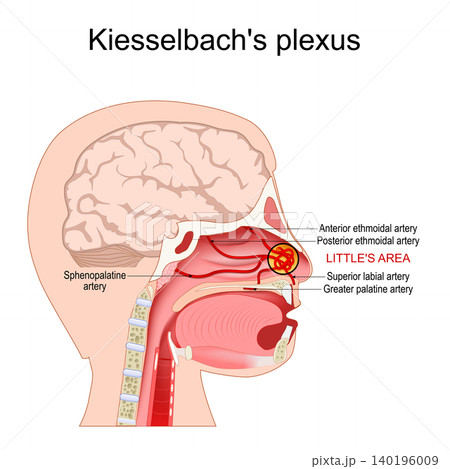 Kiesselbachs plexus. Anastomotic arterial network for nosebleeds. Kiesselbachs plexus. Anastomotic arterial network for nosebleeds. 140196009