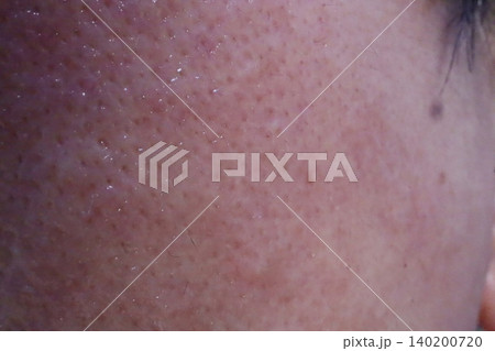 Close-up of Human Skin Texture Close-up of Human Skin Texture 140200720