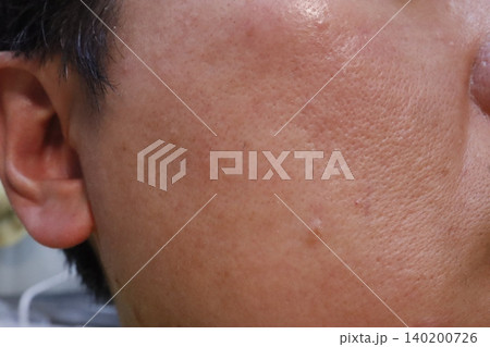 Close-up of Human Skin Near Ear 140200726