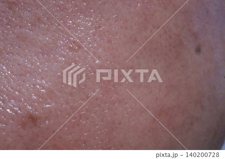 Close-Up of Human Skin Texture Close-Up of Human Skin Texture 140200728