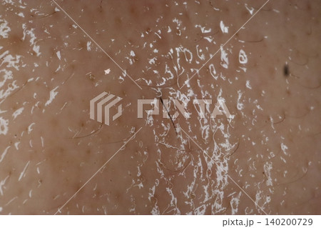 Close-up of Human Skin Texture with Hair and Flakes Close-up of Human Skin Texture with Hair and Flakes 140200729