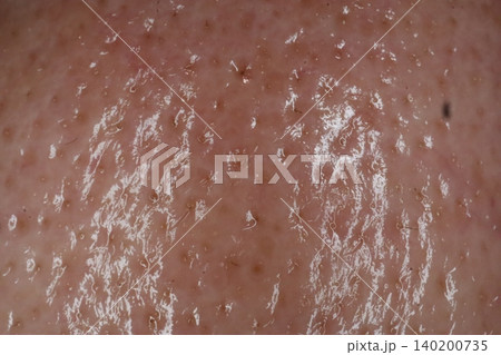 Close-up of Human Skin Texture 140200735