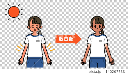 日焼けによる時間の経過を表現した図解 日焼けによる時間の経過を表現した図解 140207788