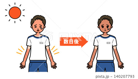 日焼けによる時間の経過を表現した図解 日焼けによる時間の経過を表現した図解 140207793
