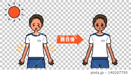日焼けによる時間の経過を表現した図解 日焼けによる時間の経過を表現した図解 140207793