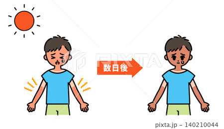 日焼けによる時間の経過を表現した図解 日焼けによる時間の経過を表現した図解 140210044