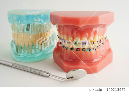 Teeth dental model with tool for dentist use to cleaning care treatment. Teeth dental model with tool for dentist use to cleaning care treatment. 140213473