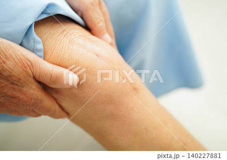Asian elderly woman patient with scar knee replacement surgery in hospital. Asian elderly woman patient with scar knee replacement surgery in hospital. 140227881