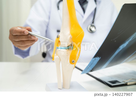 Doctor examining knee joint bone radiography xray film. Doctor examining knee joint bone radiography xray film. 140227907