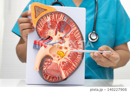 Chronic kidney disease, doctor with model for treatment urinary system, urology, Estimated glomerular filtration rate eGFR. Chronic kidney disease, doctor with model for treatment urinary system, urology, Estimated glomerular filtration rate eGFR. 140227908