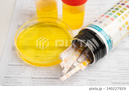 Urinalysis, urine cup with reagent strip pH paper test and comparison chart in laboratory. Urinalysis, urine cup with reagent strip pH paper test and comparison chart in laboratory. 140227929