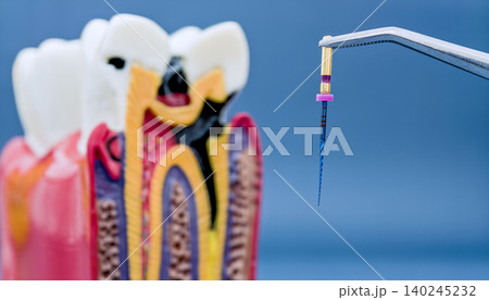 Macro view of endodontic rotary file in tweezers with blurred cross-section tooth model in background. Root canal treatment concept. Macro view of endodontic rotary file in tweezers with blurred cross-section tooth model in background. Root canal treatment concept. 140245232
