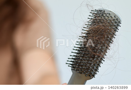 Close-up of a hairbrush full of lost hair after combing. Hair loss problem, alopecia, or shedding concept with a blurred woman holding a brush on a bright background Close-up of a hairbrush full of lost hair after combing. Hair loss problem, alopecia, or shedding concept with a blurred woman holding a brush on a bright background 140263899