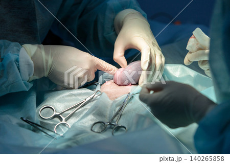 Veterinary surgery, operation, laparotomy. Close up of cesarean section of cat Veterinary surgery, operation, laparotomy. Close up of cesarean section of cat 140265858