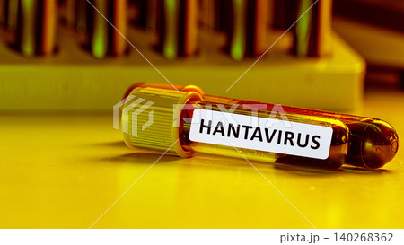 Hantavirus labeled test tube on a laboratory bench with other tubes in background Hantavirus labeled test tube on a laboratory bench with other tubes in background 140268362