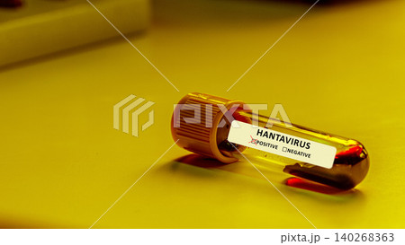 Testing for hantavirus with a sample vial on a lab table at a medical facility 140268363