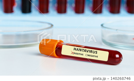 Testing blood samples for hantavirus at a laboratory in the evening Testing blood samples for hantavirus at a laboratory in the evening 140268746