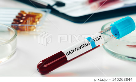 Testing for hantavirus in a laboratory with blood samples and medical equipment Testing for hantavirus in a laboratory with blood samples and medical equipment 140268844