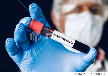 Laboratory worker holds a hantavirus blood sample in a test tube with protective gear Laboratory worker holds a hantavirus blood sample in a test tube with protective gear 140268954