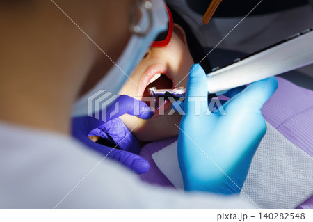 Child Receiving Dental Treatment at Dentist, Close-up Child Receiving Dental Treatment at Dentist, Close-up 140282548
