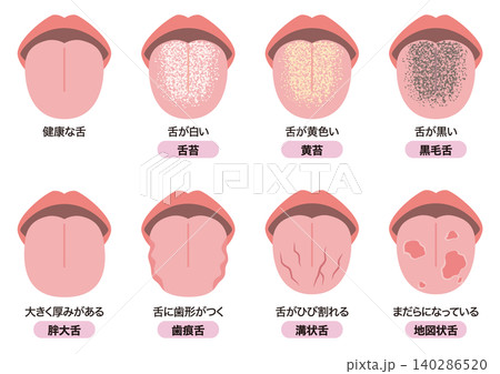 舌でわかる健康状態 140286520